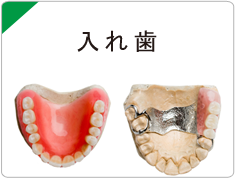 西宮市武庫川(むこがわ)鳴尾、小松北町にある歯医者 まつうら歯科クリニックの入れ歯